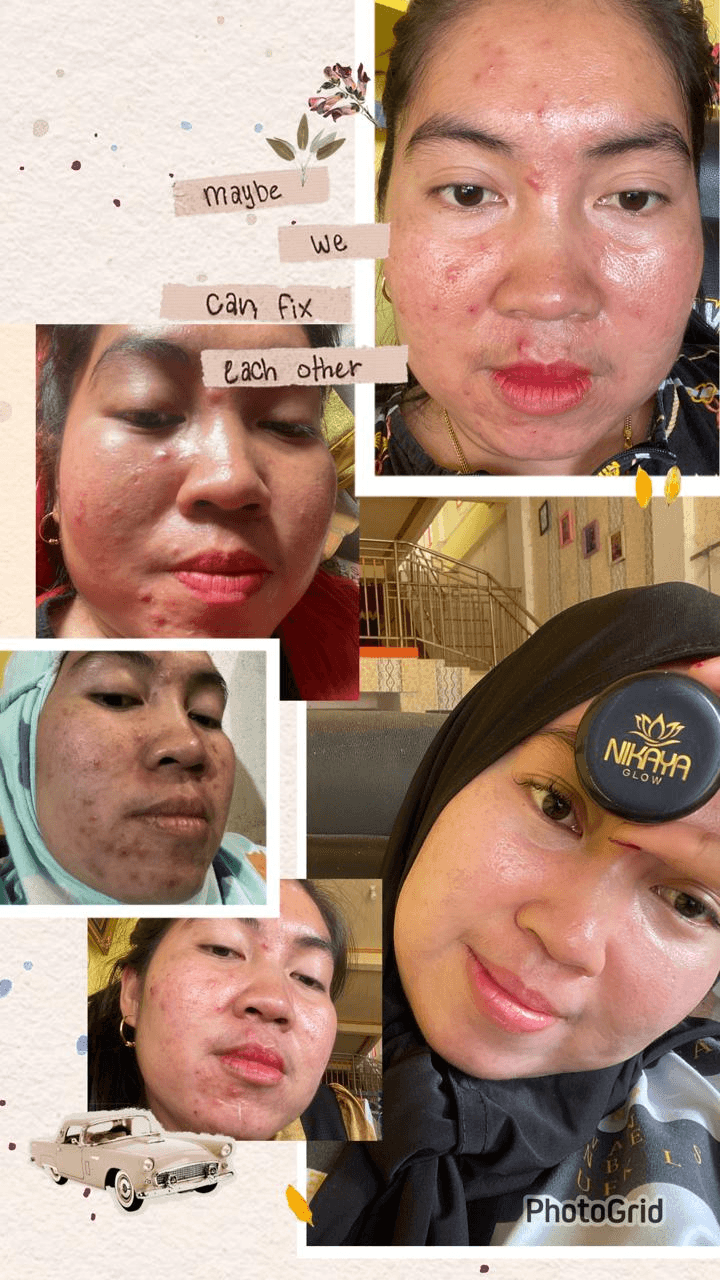 Testimoni Nikaya Glow 1