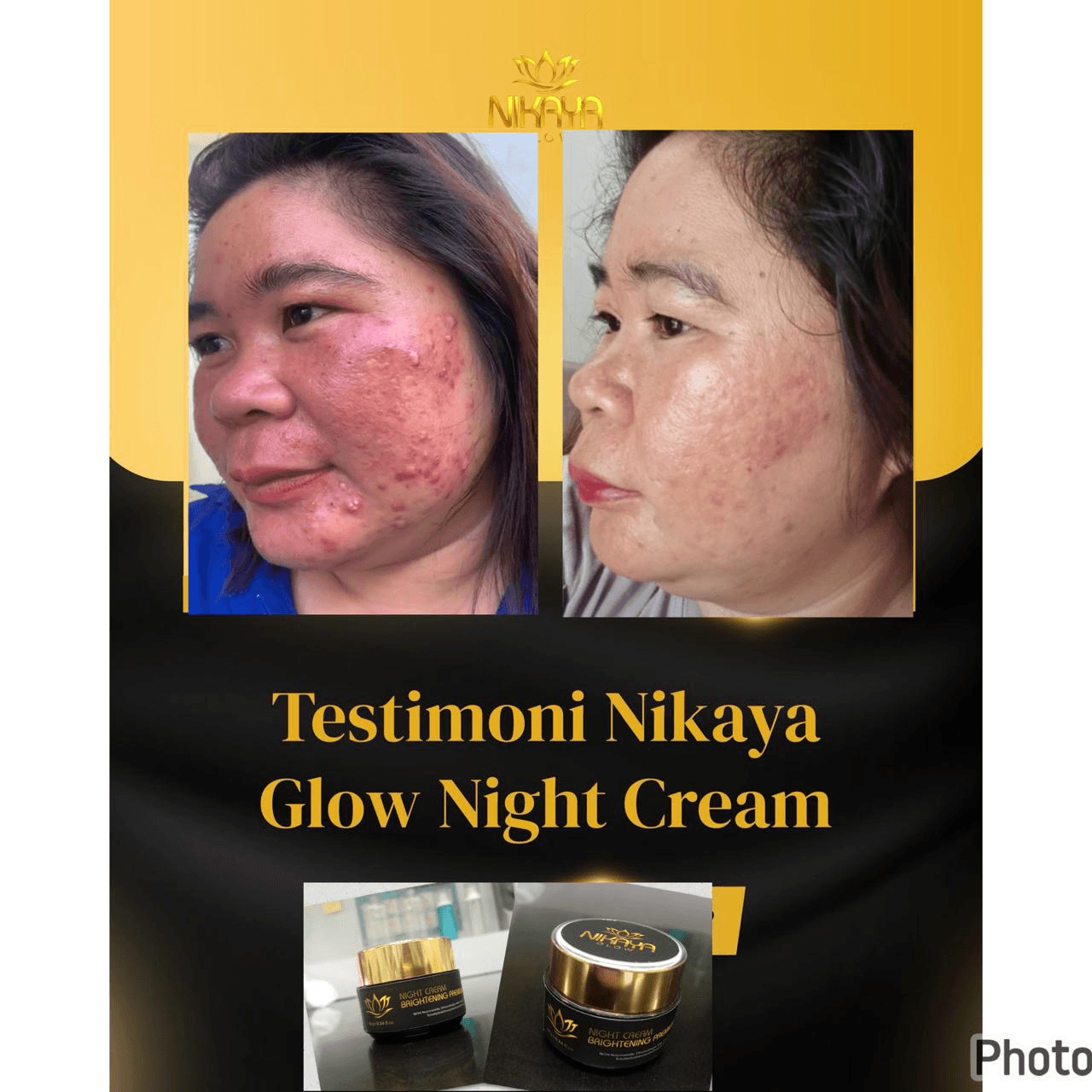 Testimoni Nikaya Glow 2